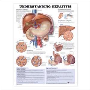  Hepatitis Anatomical Chart 20 X 26 Industrial & Scientific