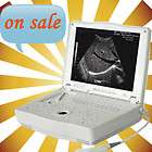 CMS600P2 Ultrasound Diagnostic System,Laptop/​Portable Ultrasound 